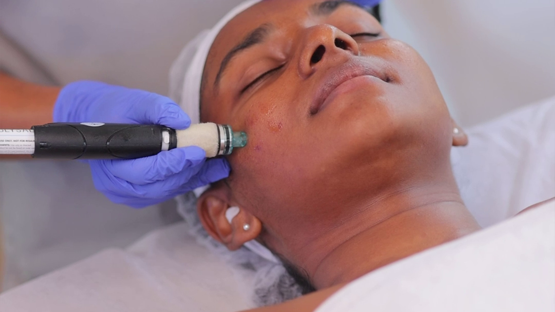 HydraFacial