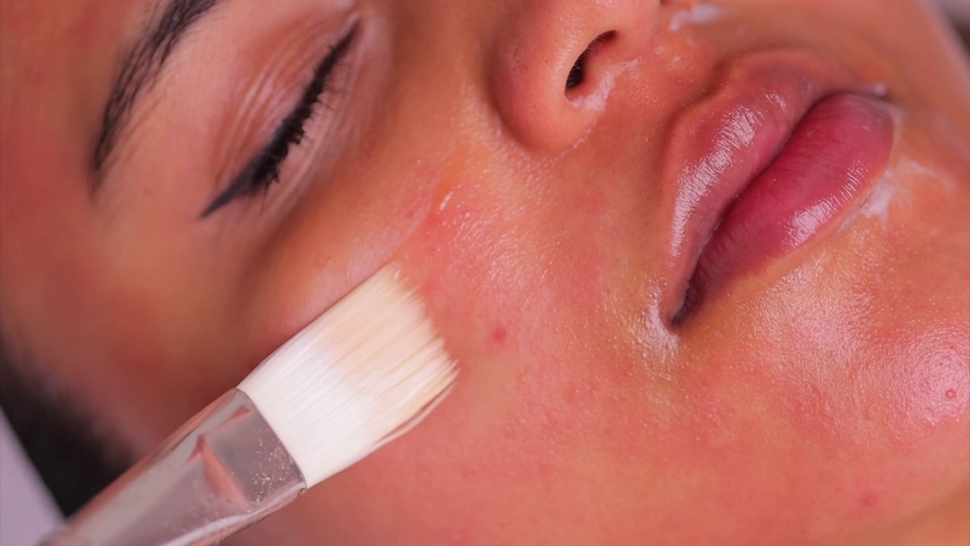 Skin Rejuvenation treatment with a brush applied on the face
