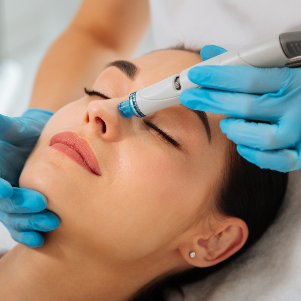 Does HydraFacial Really Remove Blackheads Effectively