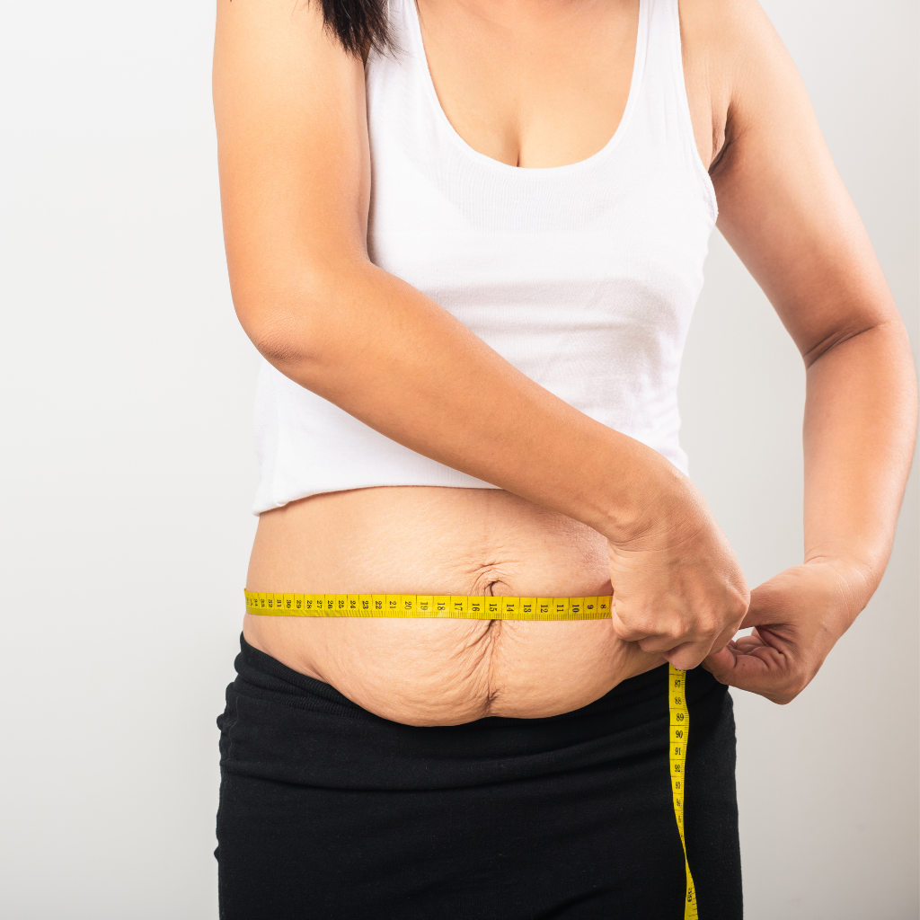 How to Tighten Stomach Skin Postpartum and Treat Loose Skin After Pregnancy