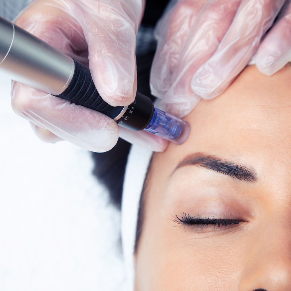 HydraFacial vs Microneedling: Which Gives Better Results?