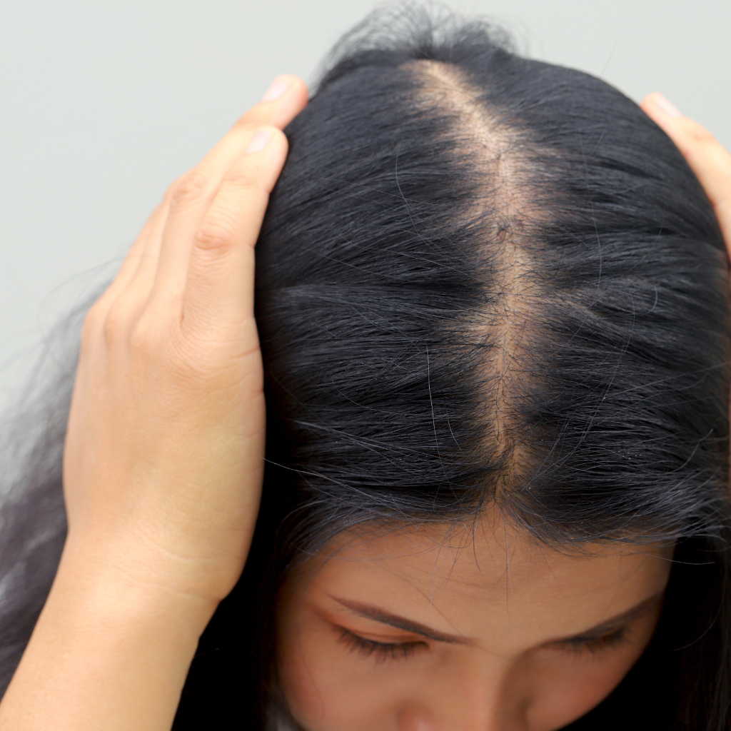 When to Start Hair Loss Treatment for Indian Men and Women